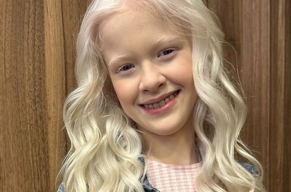 Menina albina faz apelo comovente por respeito na volta &agrave;s aulas